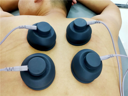 18Hz ESWT 물리적 충격파 치료 기계 전자 근육 자극