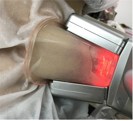 셀룰라이트 Redction을 위한 두 배 채널 유형 Cryolipolysis 지방 어는 기계