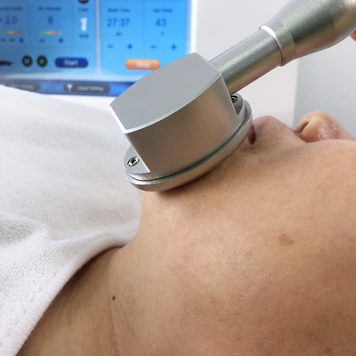 선택 가능한 깊이 2MHZ Microneedling 분수 RF 흉터 감소